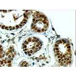 Immunohistochemistry - Anti-APE1 Antibody (A83661) - Antibodies.com