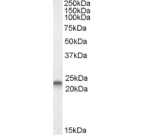 Western Blot - Anti-Caveolin-3 Antibody (A83663) - Antibodies.com