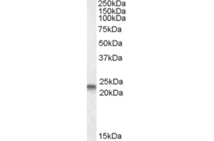 Western Blot - Anti-Caveolin-3 Antibody (A83663) - Antibodies.com