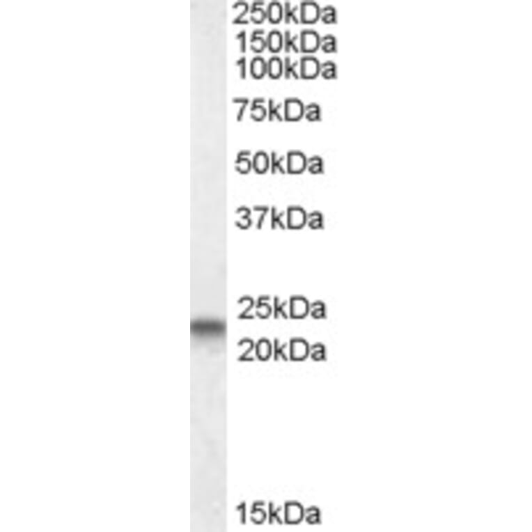 Western Blot - Anti-Caveolin-3 Antibody (A83663) - Antibodies.com