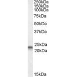 Western Blot - Anti-Caveolin-3 Antibody (A83663) - Antibodies.com