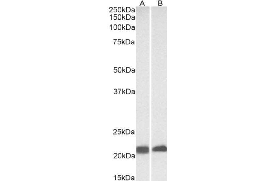 Western Blot - Anti-Caveolin-3 Antibody (A83663) - Antibodies.com