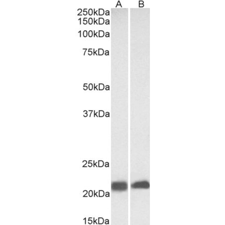 Western Blot - Anti-Caveolin-3 Antibody (A83663) - Antibodies.com