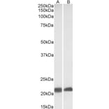 Western Blot - Anti-Caveolin-3 Antibody (A83663) - Antibodies.com