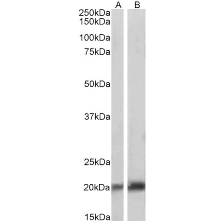 Western Blot - Anti-Caveolin-3 Antibody (A83663) - Antibodies.com