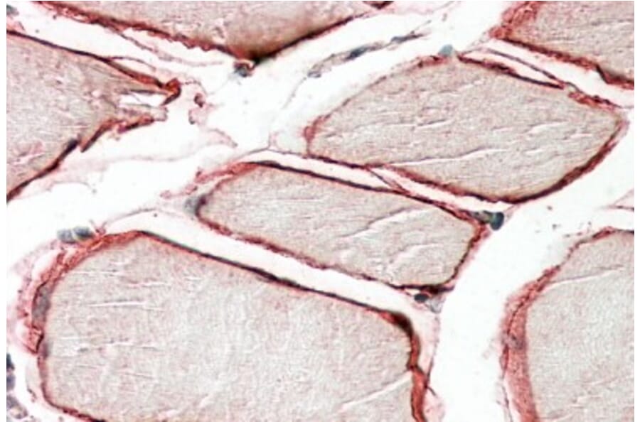 Immunohistochemistry - Anti-Caveolin-3 Antibody (A83663) - Antibodies.com