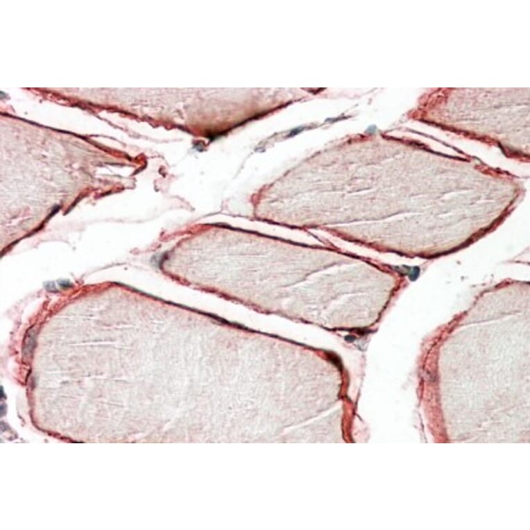 Immunohistochemistry - Anti-Caveolin-3 Antibody (A83663) - Antibodies.com