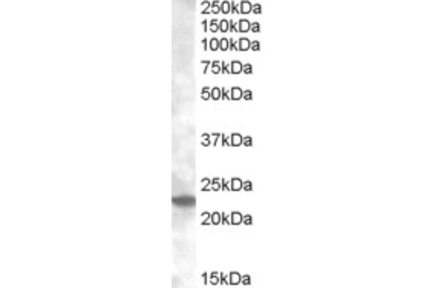 Western Blot - Anti-Rab17 Antibody (A83664) - Antibodies.com