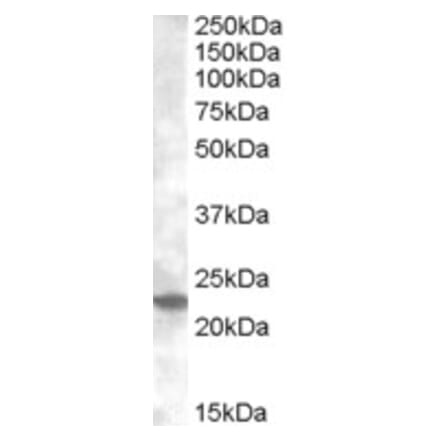 Western Blot - Anti-Rab17 Antibody (A83664) - Antibodies.com