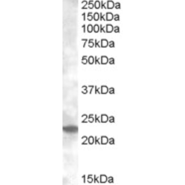 Western Blot - Anti-Rab17 Antibody (A83664) - Antibodies.com