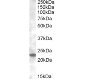 Western Blot - Anti-Rab17 Antibody (A83664) - Antibodies.com