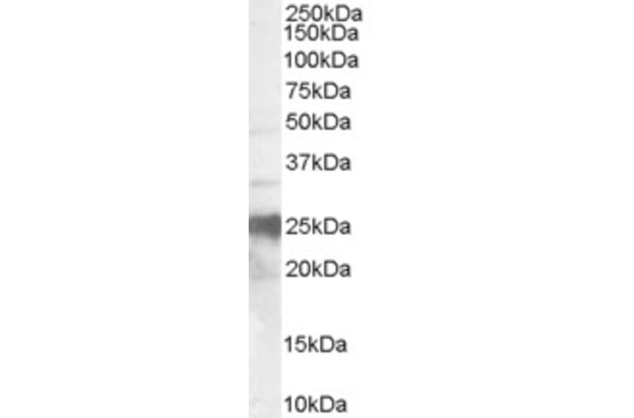 Western Blot - Anti-Alternative Prion Protein/PRNP Antibody (A83666) - Antibodies.com