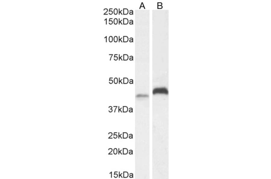 Western Blot - Anti-RNF13 Antibody (A83667) - Antibodies.com