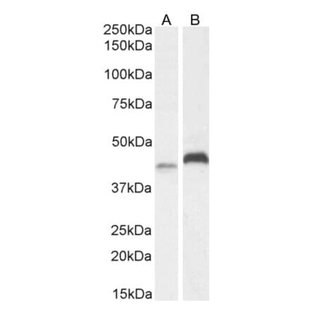 Western Blot - Anti-RNF13 Antibody (A83667) - Antibodies.com