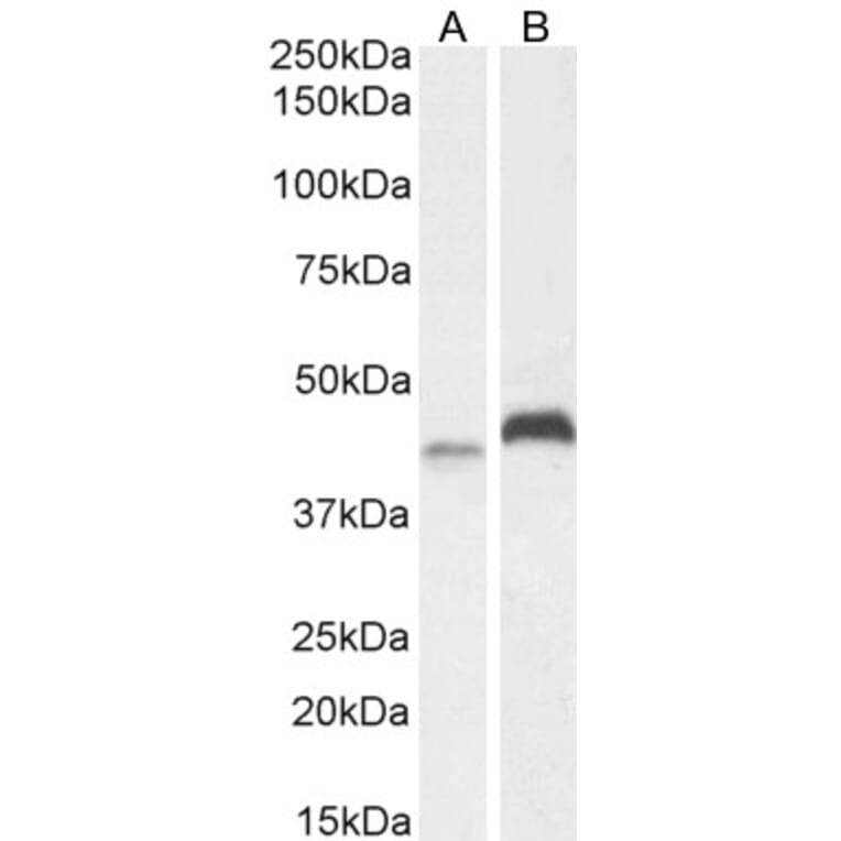 Western Blot - Anti-RNF13 Antibody (A83667) - Antibodies.com
