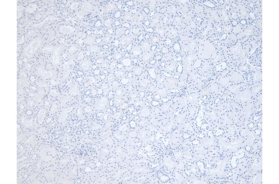 Immunohistochemistry - Anti-RNF13 Antibody (A83667) - Antibodies.com