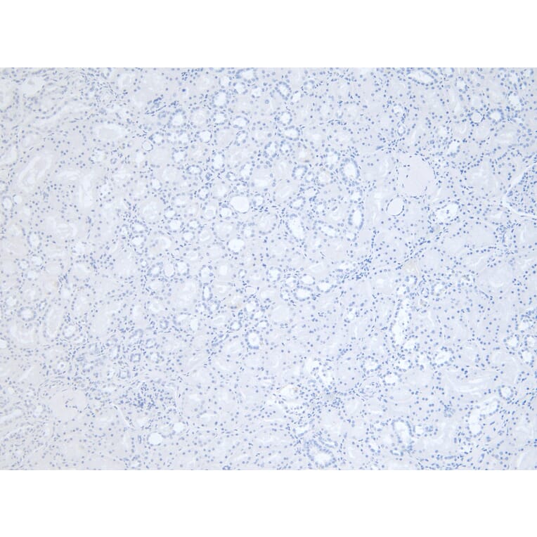 Immunohistochemistry - Anti-RNF13 Antibody (A83667) - Antibodies.com