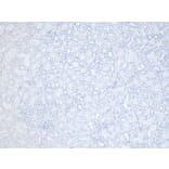Immunohistochemistry - Anti-RNF13 Antibody (A83667) - Antibodies.com