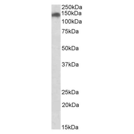 Western Blot - Anti-SMC2 Antibody (A83669) - Antibodies.com