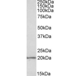 Western Blot - Anti-eIF5A Antibody (A83670) - Antibodies.com