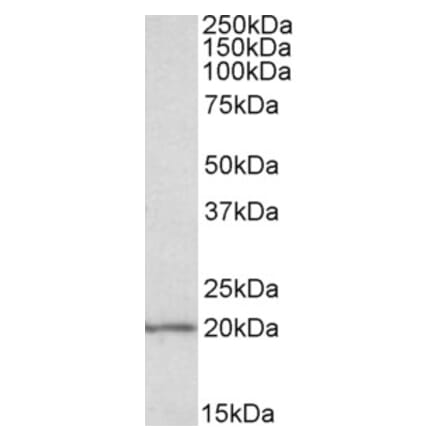 Western Blot - Anti-eIF5A Antibody (A83670) - Antibodies.com