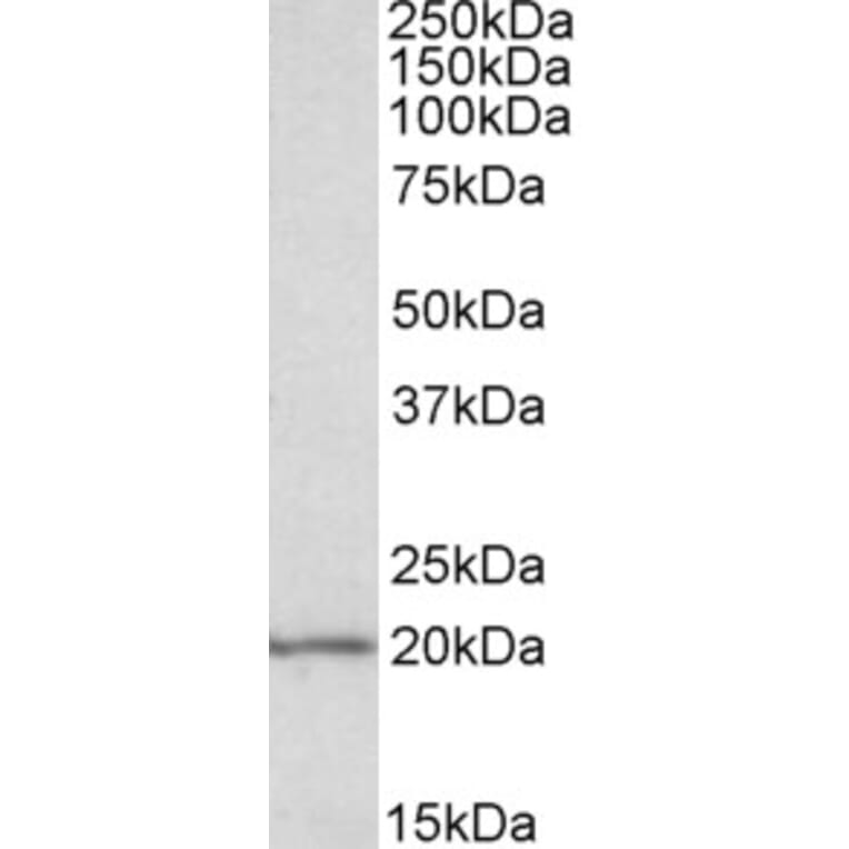 Western Blot - Anti-eIF5A Antibody (A83670) - Antibodies.com