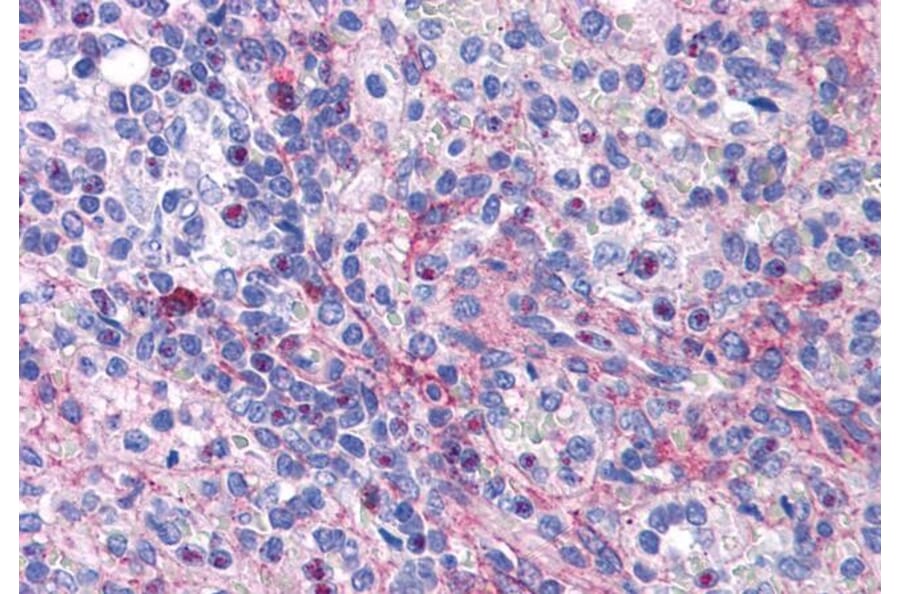 Immunohistochemistry - Anti-eIF5A Antibody (A83670) - Antibodies.com