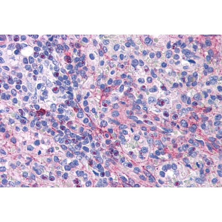 Immunohistochemistry - Anti-eIF5A Antibody (A83670) - Antibodies.com