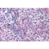 Immunohistochemistry - Anti-eIF5A Antibody (A83670) - Antibodies.com