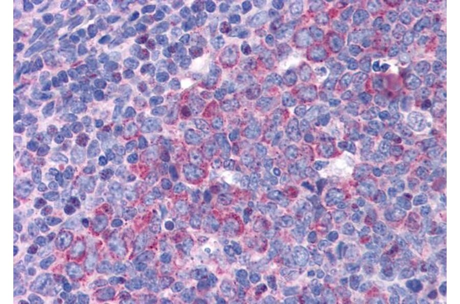 Immunohistochemistry - Anti-eIF5A Antibody (A83670) - Antibodies.com
