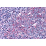 Immunohistochemistry - Anti-eIF5A Antibody (A83670) - Antibodies.com