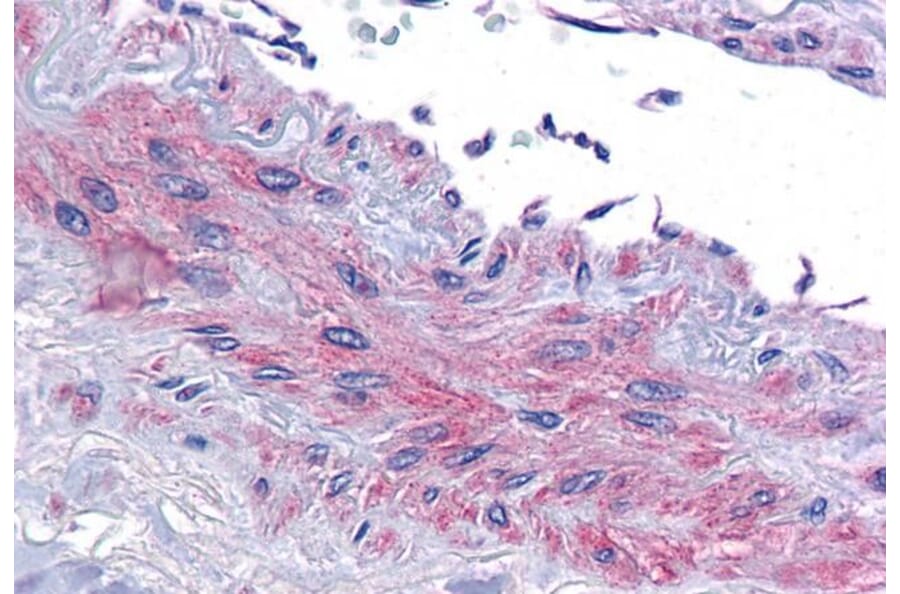 Immunohistochemistry - Anti-eIF5A Antibody (A83670) - Antibodies.com