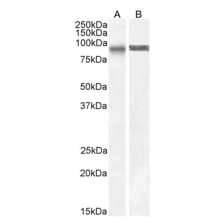 Western Blot - Anti-SATB1 Antibody (A83671) - Antibodies.com