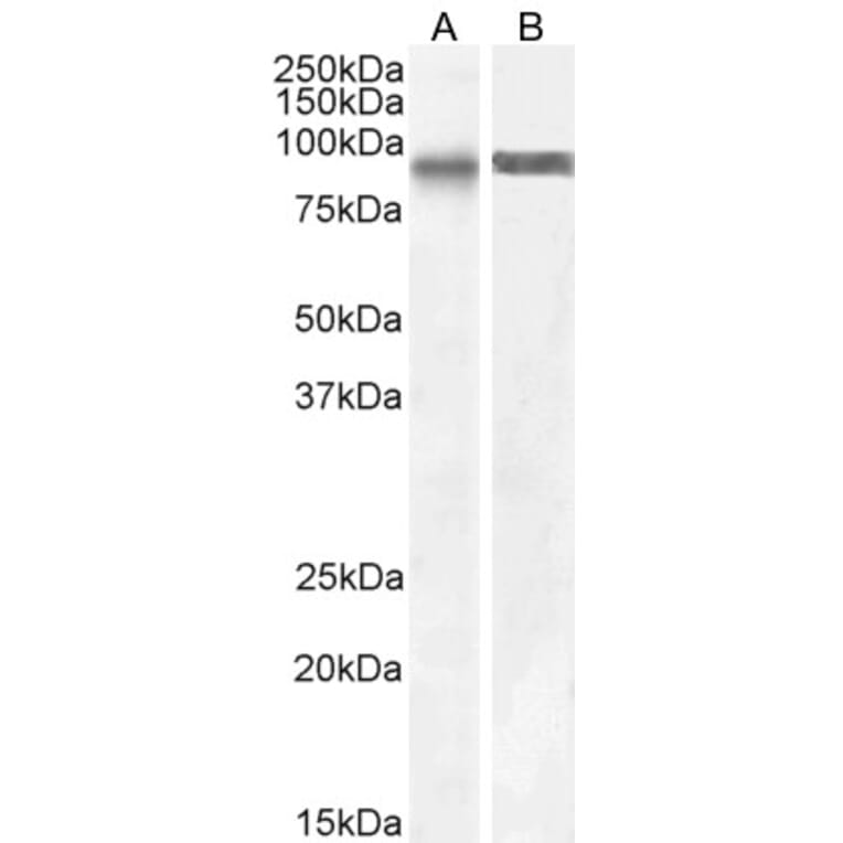 Western Blot - Anti-SATB1 Antibody (A83671) - Antibodies.com