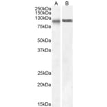 Western Blot - Anti-SATB1 Antibody (A83671) - Antibodies.com