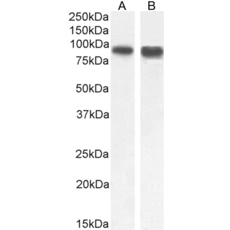 Western Blot - Anti-SATB1 Antibody (A83671) - Antibodies.com
