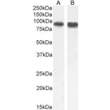 Western Blot - Anti-SATB1 Antibody (A83671) - Antibodies.com