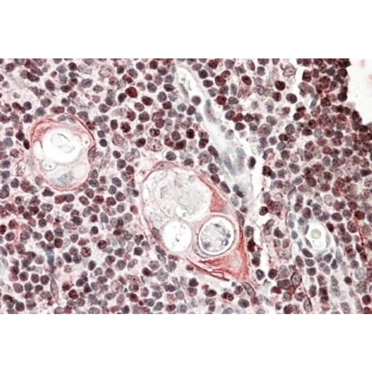Immunohistochemistry - Anti-SATB1 Antibody (A83671) - Antibodies.com