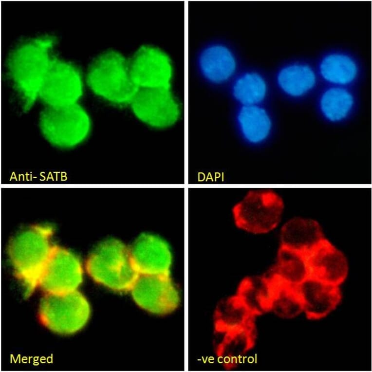 Immunofluorescence - Anti-SATB1 Antibody (A83671) - Antibodies.com