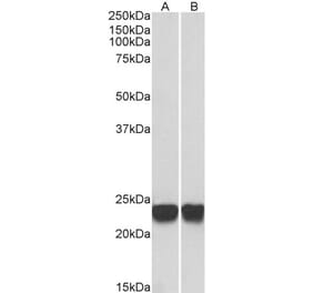 Western Blot - Anti-PARK7 Antibody (A83672) - Antibodies.com