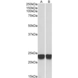 Western Blot - Anti-PARK7 Antibody (A83672) - Antibodies.com