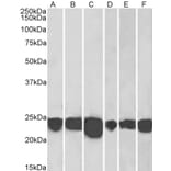 Western Blot - Anti-PARK7 Antibody (A83672) - Antibodies.com