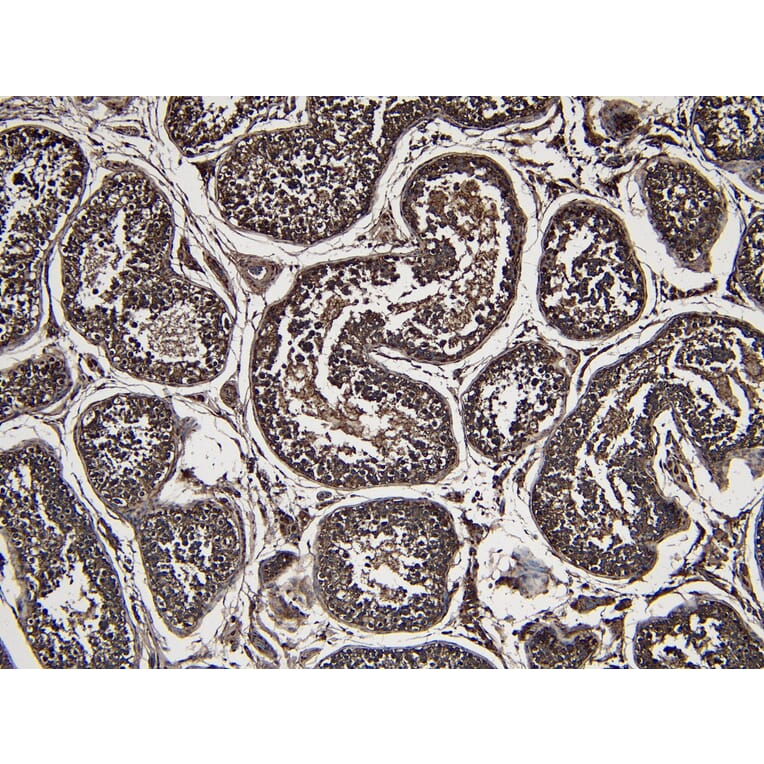 Immunohistochemistry - Anti-PARK7 Antibody (A83672) - Antibodies.com