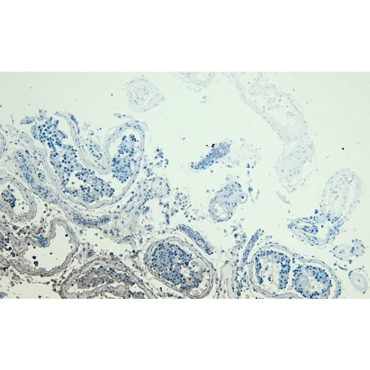 Immunohistochemistry - Anti-PARK7 Antibody (A83672) - Antibodies.com