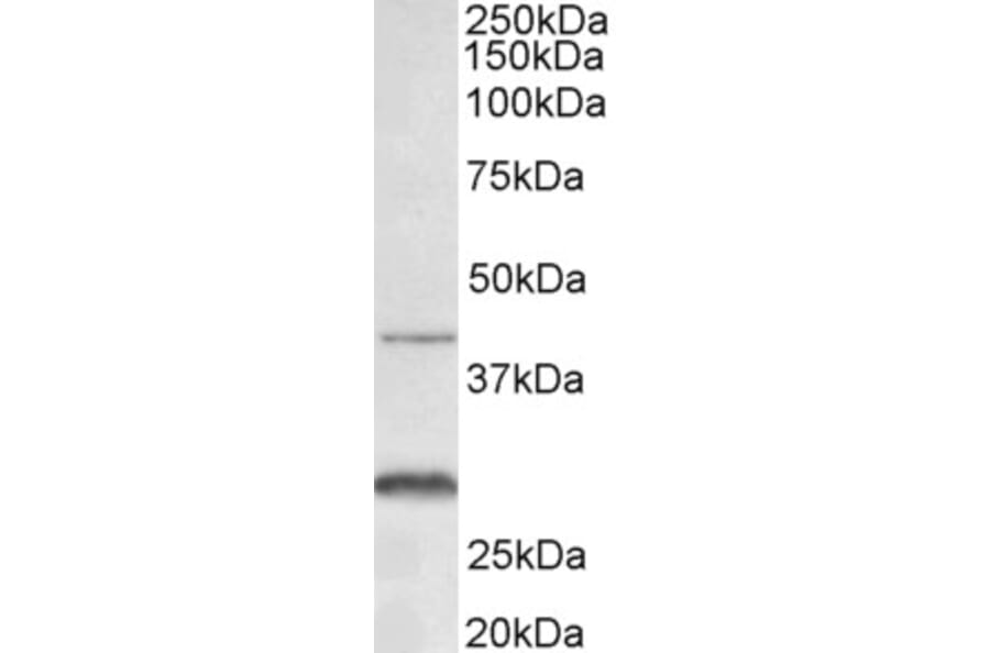 Western Blot - Anti-CXCR2 Antibody (A83674) - Antibodies.com