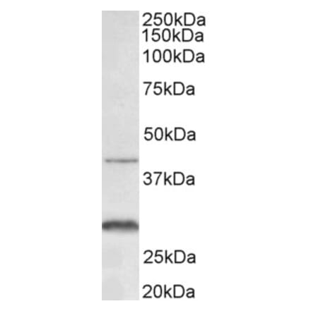 Western Blot - Anti-CXCR2 Antibody (A83674) - Antibodies.com