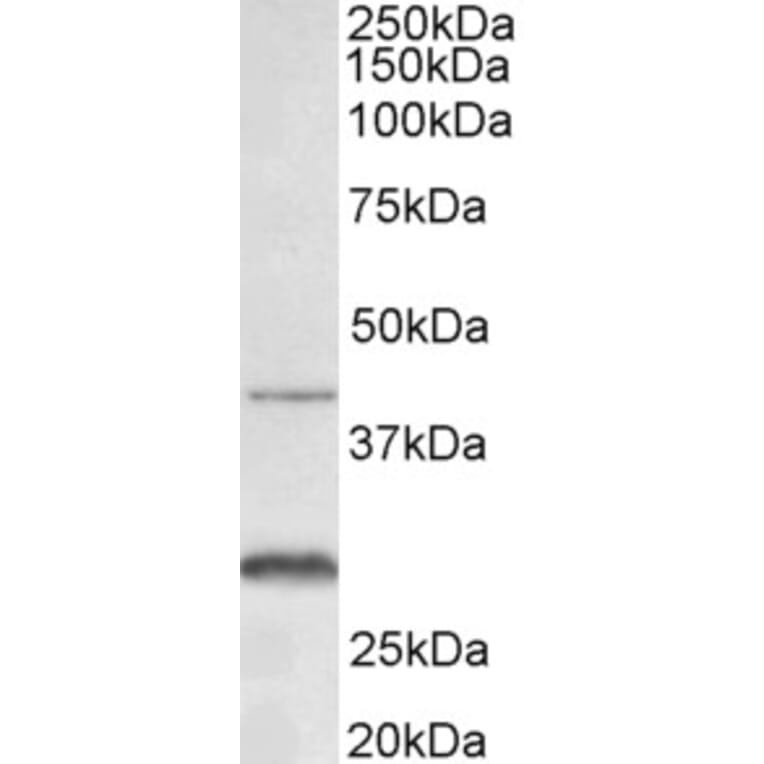 Western Blot - Anti-CXCR2 Antibody (A83674) - Antibodies.com