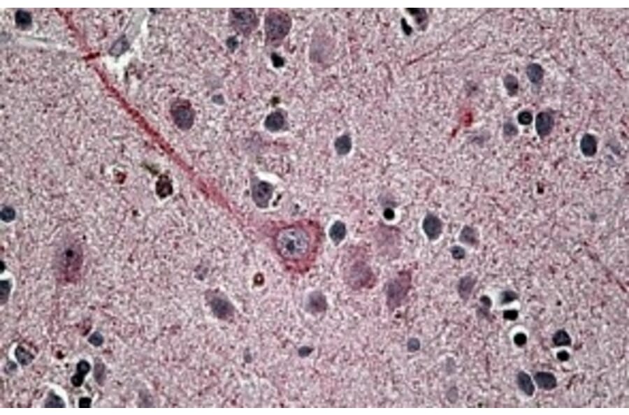 Immunohistochemistry - Anti-SYT1 Antibody (A83675) - Antibodies.com