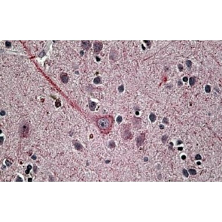Immunohistochemistry - Anti-SYT1 Antibody (A83675) - Antibodies.com