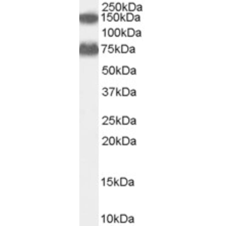 Western Blot - Anti-ACOX2 Antibody (A83677) - Antibodies.com